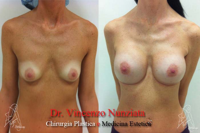 Paziente 4