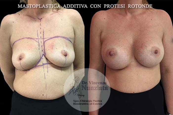 Paziente 9
