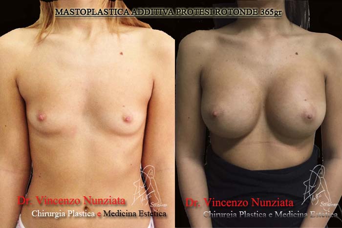 Paziente 5