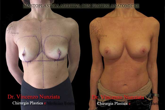 Paziente 5