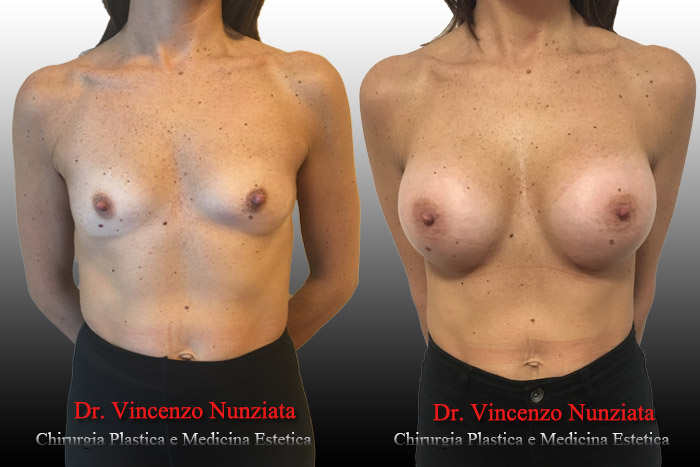 Paziente 12