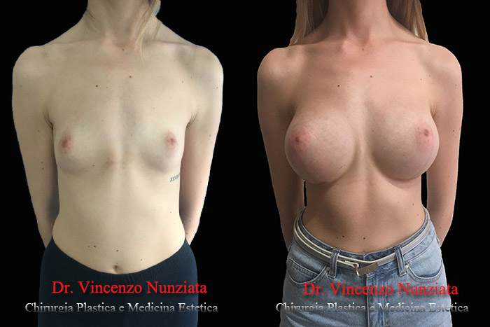 Paziente 14