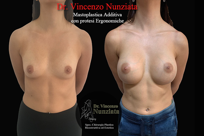 Paziente 2