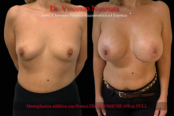 Paziente 3