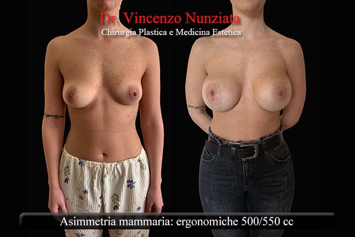 Paziente 4
