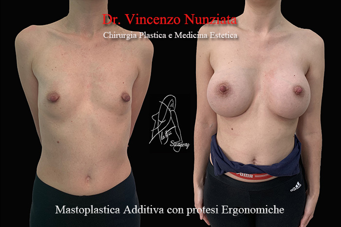 Paziente 5