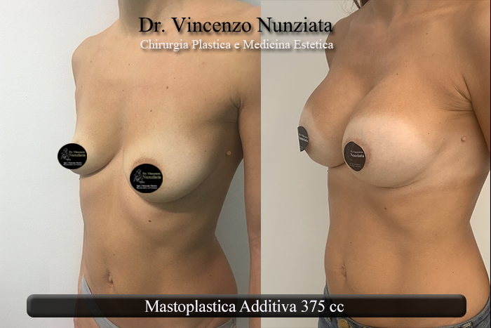 Paziente 26