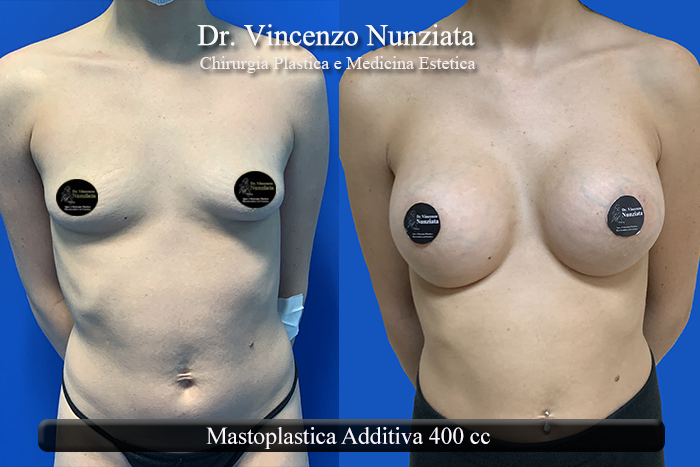Paziente 28
