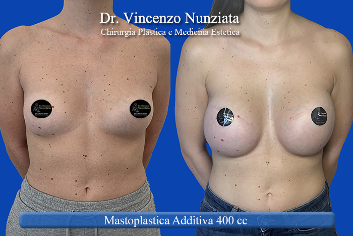 Paziente 7