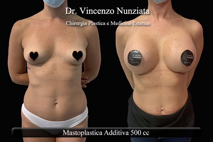 Paziente 9