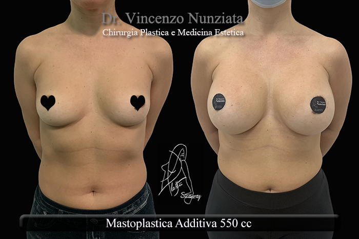 Paziente 29