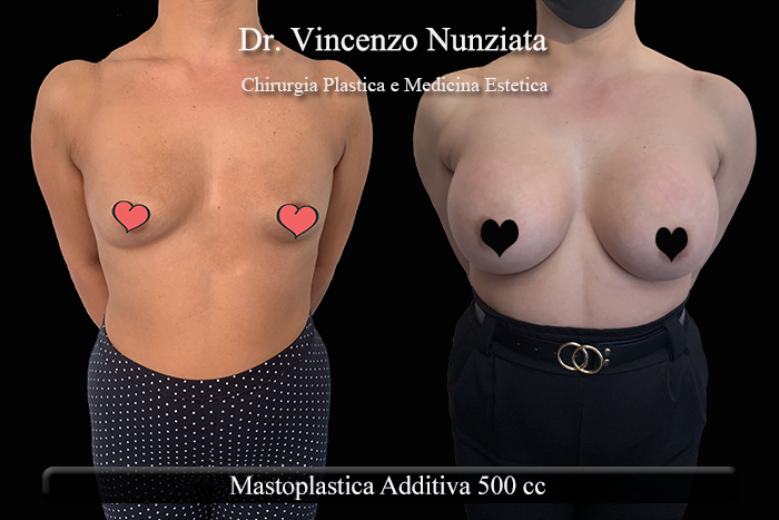 Paziente 10