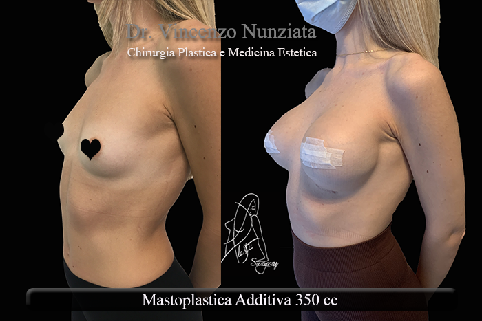 Paziente 30