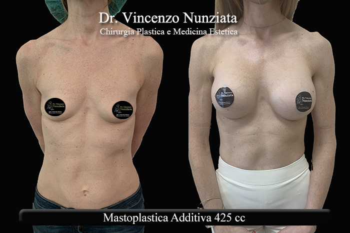 Paziente 13