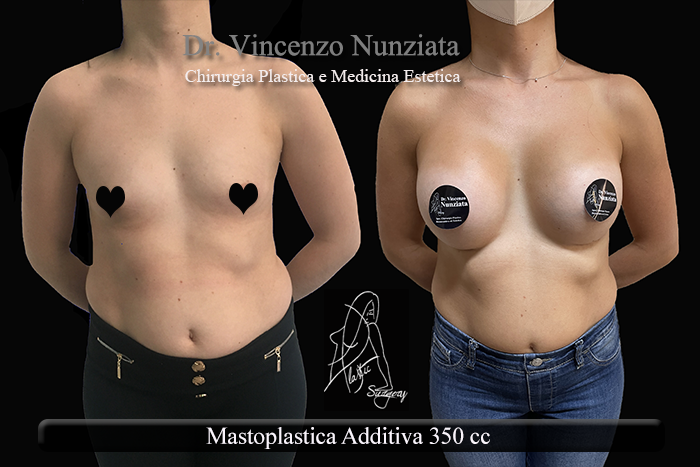 Paziente 31