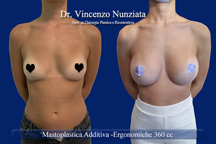 Paziente 14
