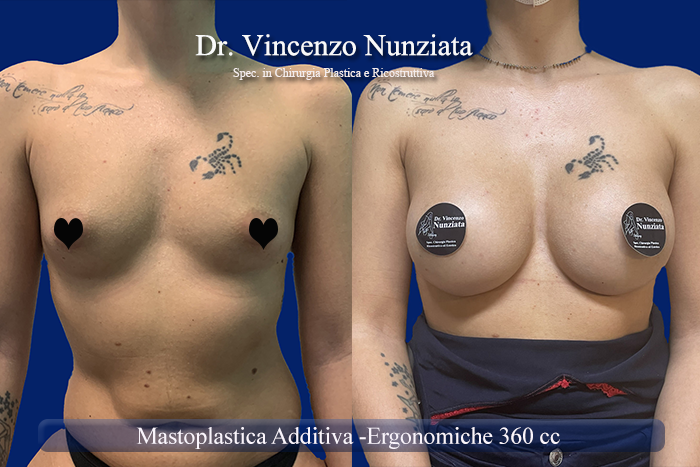 Paziente 15