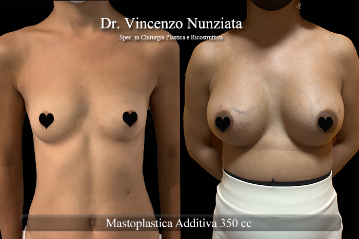 Paziente 38