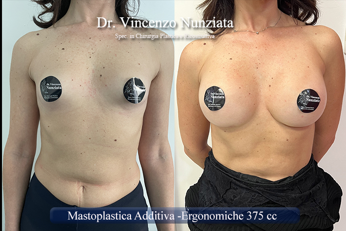 Paziente 23