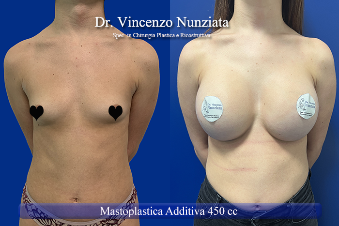 Paziente 39