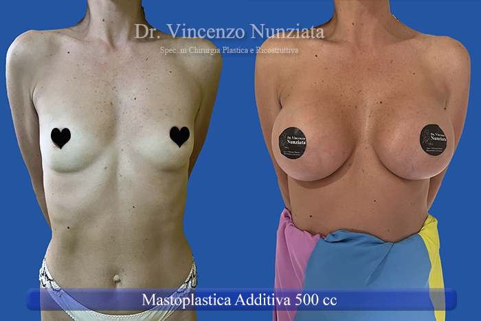 Paziente 44
