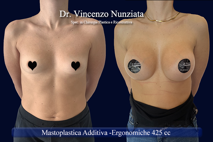 Paziente 25