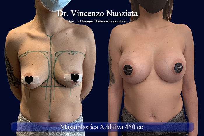Paziente 42