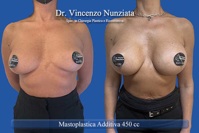 Paziente 45