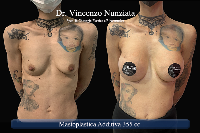 Paziente 26