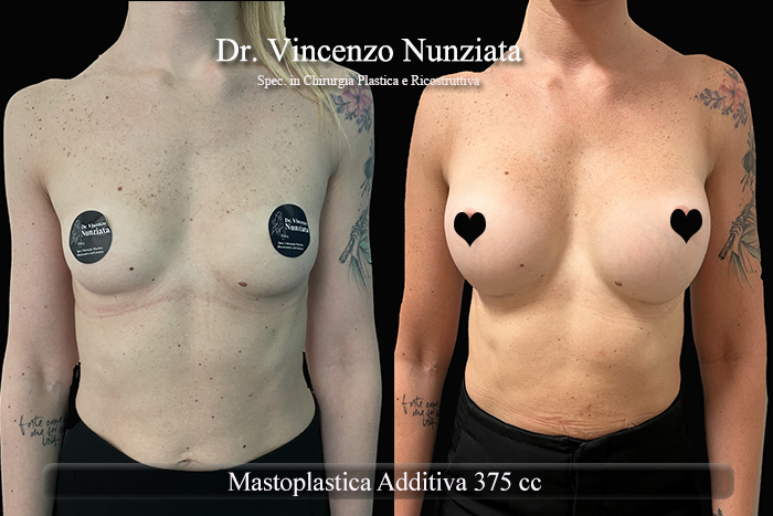 Paziente 41