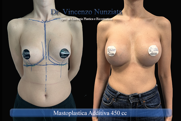 Paziente 48