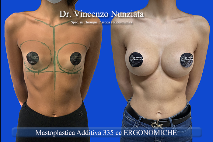 Paziente 27
